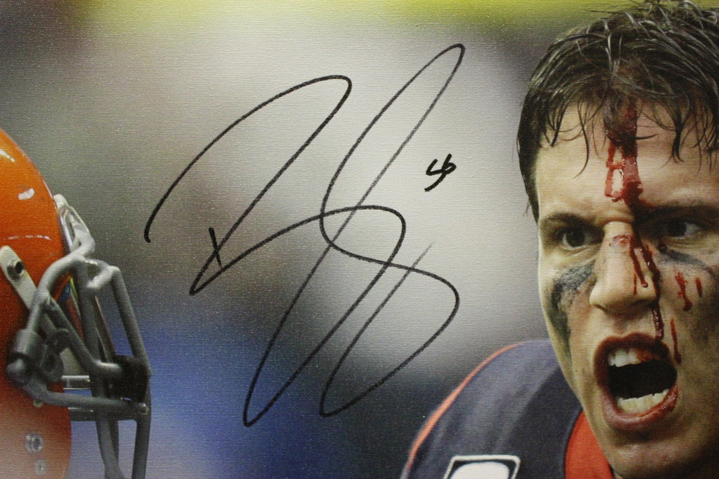 Brian Cushing Autographed Houston Texans 20x24 Bloody Face Canvas