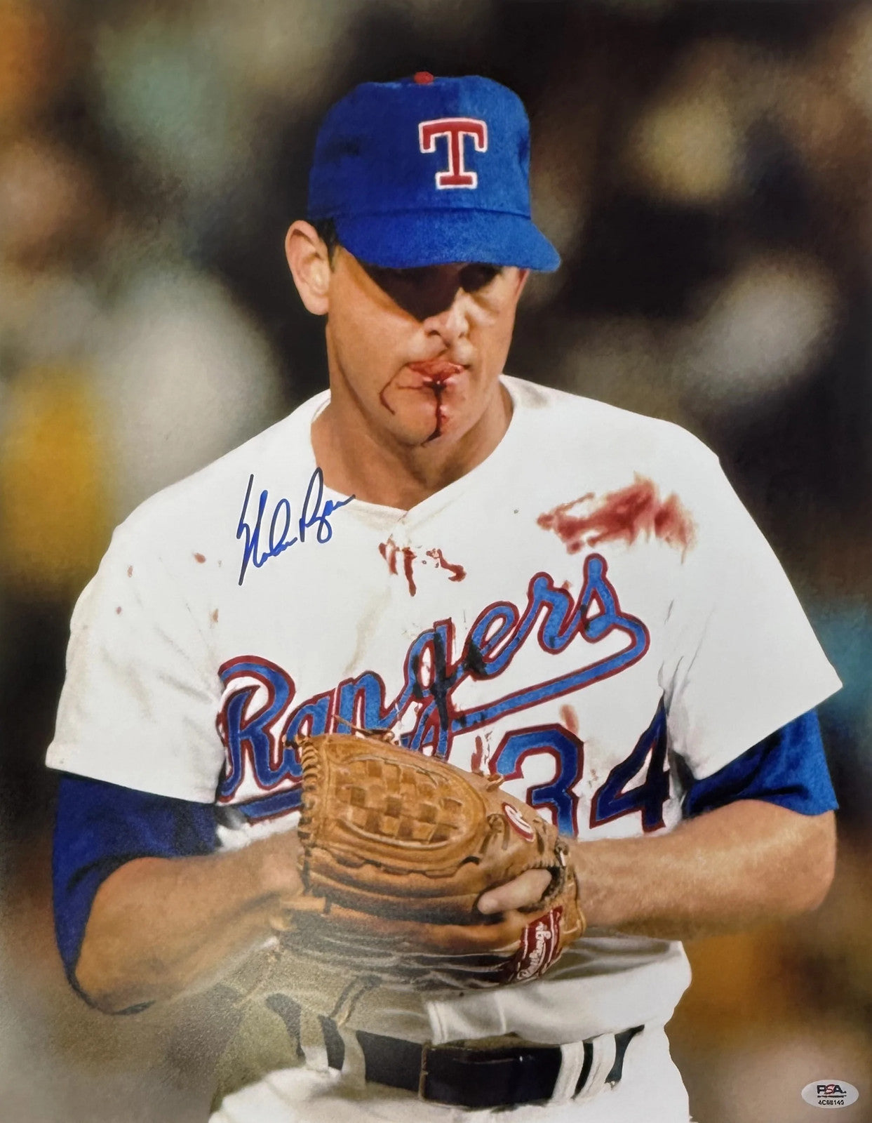 Nolan Ryan Signed Texas Rangers 16x20 Bloody Lip Photo