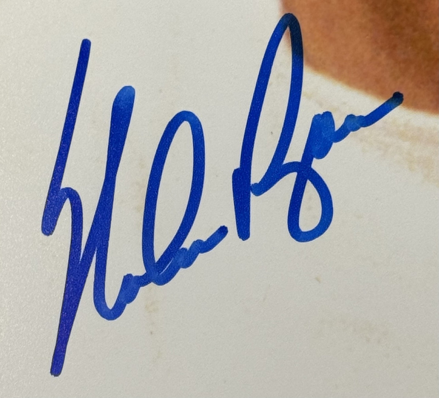 Nolan Ryan Signed Texas Rangers 16x20 Bloody Lip Photo